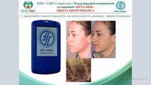 Демодекс  Как лечить