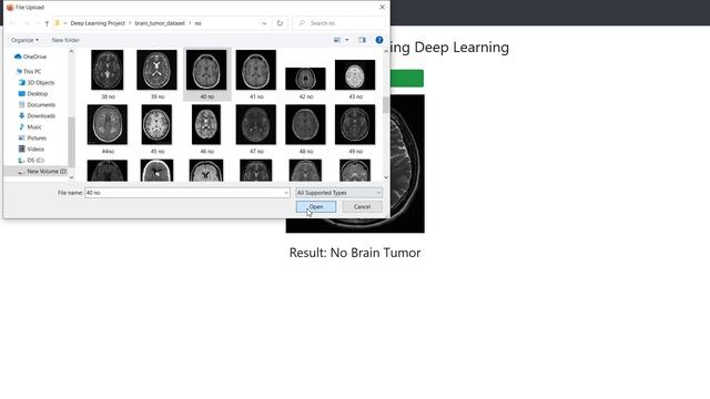 Deep Learning Project:Brain Tumor Classification | DEMO | Keras Python Tensorflow | KNOWLEDGE DOCTO