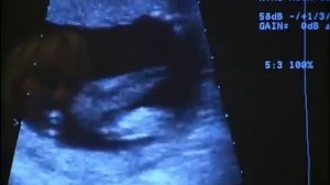 Все этапы беременности