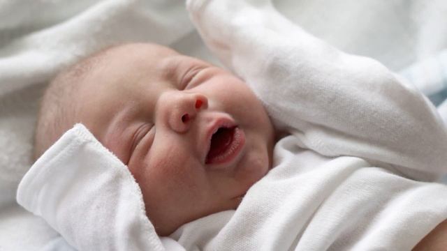 ВРОЖДЕННАЯ СЛЕЗНО-НОСОВАЯ НЕПРОХОДИМОСТЬ | Зондирование слезного канала и когда его нужно делать смотреть онлайн