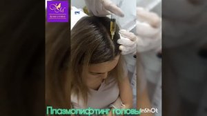 Плазмолифтинг головы