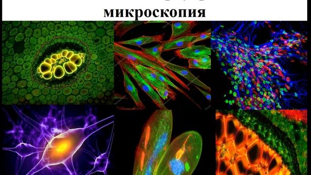 Различие между разрешением и увеличением оптического  и электроного микроскопов 11 кл БИОЛОГИЯ ЕМН