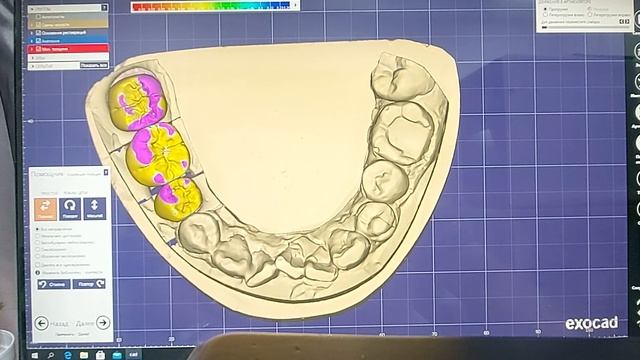 моделировка в CAD CAM быстро и просто обучение