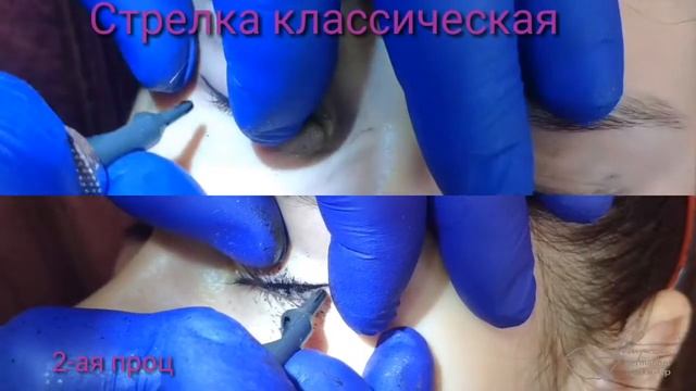 Межресничка