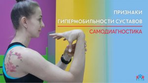 Признаки гипермобильности суставов