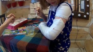 перелом!:(рисуем на гипсе!!!!!:)