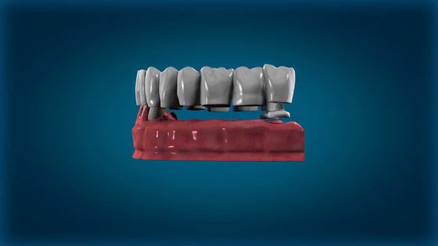 ZX27. Стеклянные опоры обеспечивают прочность и устойчивость моста смотреть онлайн