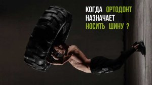 Окклюзионные шины: когда их назначает ортодонт❓