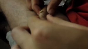 Большой прыщик 18+