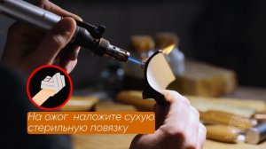 Что делать если получил термический ожог