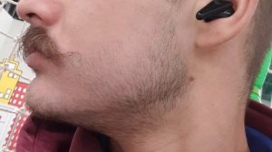 Результат за 1 год. Мой опыт миноксидил.