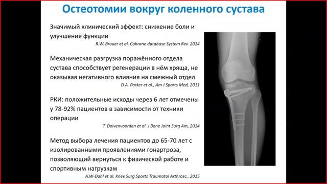 Возможности и перспективы хирургического и консервативного лечения пациентов после высокой остеотоми