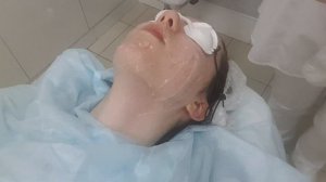 Лазерная эпиляция лица RUIKD .