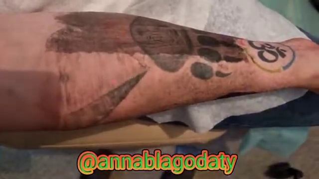 Профессиональное удаление татуировок Караганда. смотреть онлайн