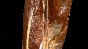 бедренная артерия