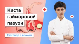 Лечение кисты гайморовой пазухи в Москве бесплатно по полису ОМС