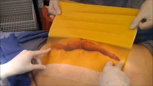 Этапы установки вак системы