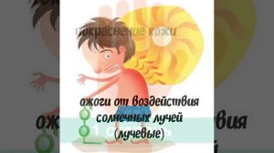 Виды и степени ожогов