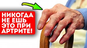 Ревматолог: Чтобы победить артрит, нужно знать это!