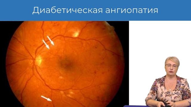 12.09.2021 16:30 АГ. Измерения АД. Критерии диагностики смотреть онлайн