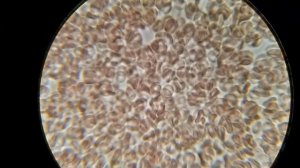 Как шоколад влияет на состояние крови