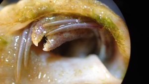 РАК-ОТШЕЛЬНИК ПОД МИКРОСКОПОМ