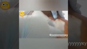 Слабонервным не смотреть! Прыщик выдавили. О май гат! смотреть онлайн видео выдавливание чирей виде