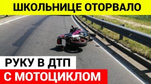 Школьнице оторвало руку в ДТП с мотоциклом