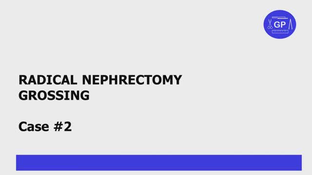 Radical nephrectomy grossing (part 2/3) - histology and anatomy