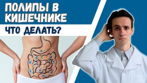 Полипы в кишечнике  Опасны ли? Диагностика. Лечение. Профилактика