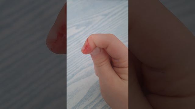 покажу вам как убрать укус мыши смотреть онлайн