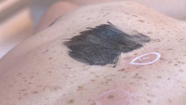 Москва, Первая Бухвостова, дом 3, клиника "Алёна". смотреть онлайн