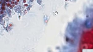 Красный костный мозг