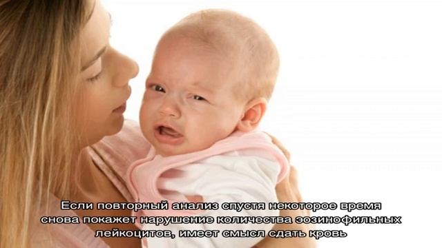 Доктор Комаровский об эозинофилах смотреть онлайн