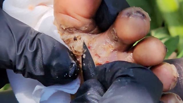 Maurice jigger digging - subscribe @riseupsociety.net for full videos ($10) смотреть онлайн