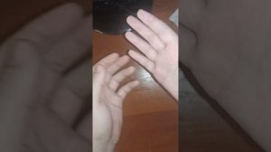 Блог о восстановлению после Перелома 3 пястной кости и разрыв (повреждение) сухожилий 2 и 3 пальца
