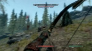 MAN vs SKYRIM - Ep 16 . catching diseases...