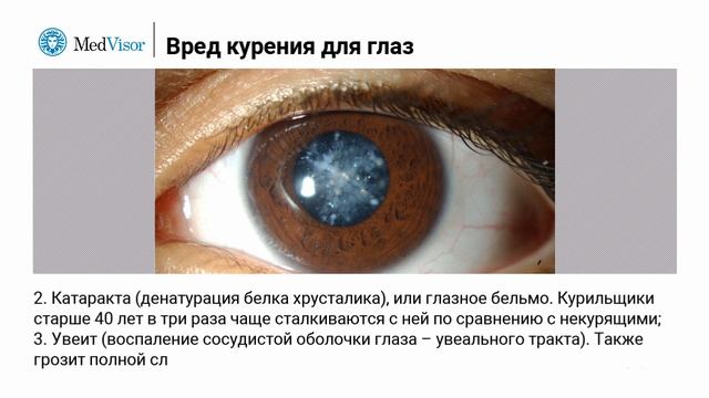 Вред курения для глаз смотреть онлайн