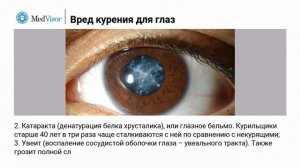 Вред курения для глаз