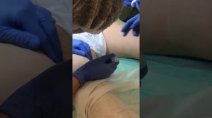 Мезотерапия и Биоревитализация. Липоскульптура тела. Практика