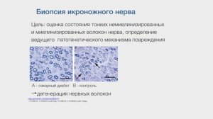 Лекция - заболевания периферической нервной системы. Часть 1.