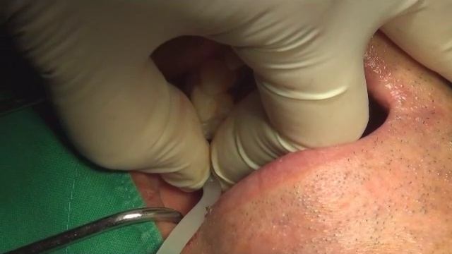 Sinus Kit Shinhung Betapharm