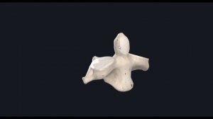 Осевой позвонок (Axis или С-2, второй шейный позвонок) 3D Анатомия