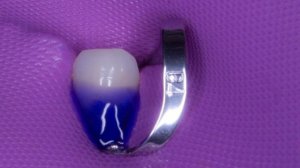 Пришеечный кариес зуба , коффердам , лечение зубов , постановка пломбы , dental dam , dental