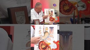 Чем опасна ИЖОГА?