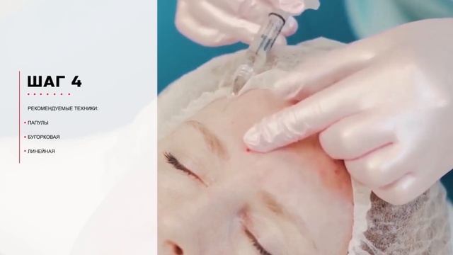 Протокол Repart 6 Delicate смотреть онлайн