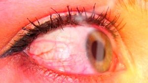 ВРЕД ЦВЕТНЫХ ЛИНЗ | вредны ли цветные линзы для глаз, срок годности цветных линз