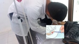 CLEANSING ENEMA. ENEMA. ADMINISTERING a CLEANSING ENEMA