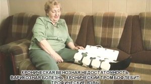 Аппарат Алмаг-02 - промо ролик