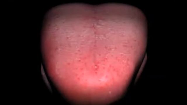 Чистка языка смотреть онлайн